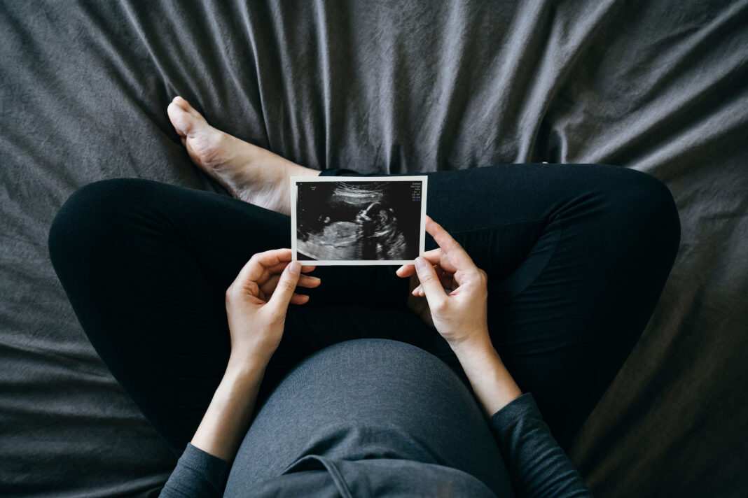 A high-angle photograph of a pregnant person sitting cross-legged on a bed and holds a sonogram of a baby.
